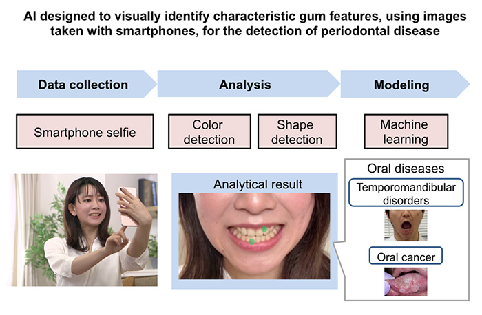 Overview of Periodontal Disease Detection AI