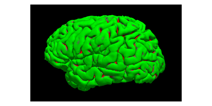 Image 1: Image of brain generated by the new AI technology